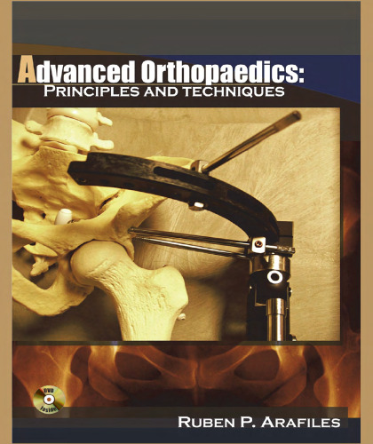 Advanced Orthopaedics: Principles and Techniques