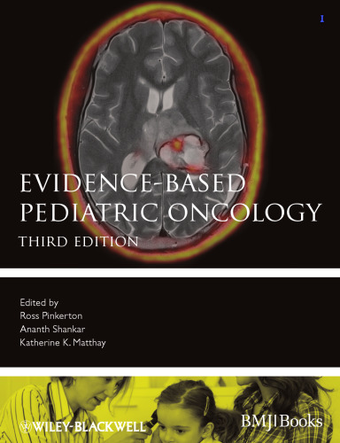 Evidence-Based Pediatric Oncology