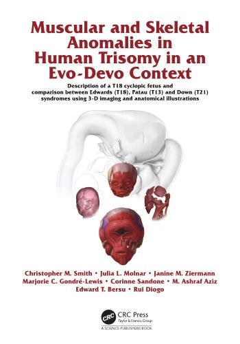 Muscular and skeletal anomalies in human trisomy in an evo-devo context : description of a T18 cyclopic fetus and comparison between Edwards (T18), Patau (T13) and Down (T21) syndromes using 3-D imaging and anatomical illustrations