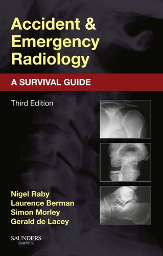 Accident and Emergency Radiology. A Survival Guide
