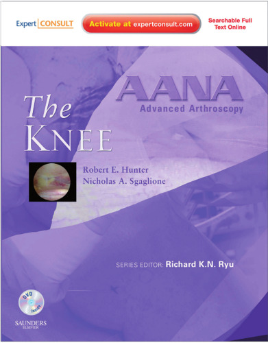 AANA Advanced Arthroscopy. The Knee