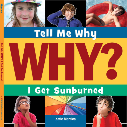 I Get Sunburned