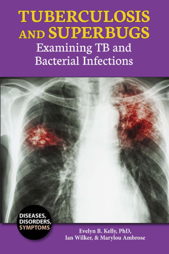Tuberculosis and Superbugs. Examining TB and Bacterial Infections