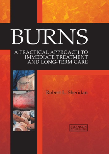 Burns : A Practical Approach to Immediate Treatment and Long Term Care