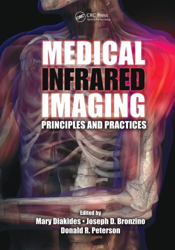 Medical Infrared Imaging : Principles and Practices