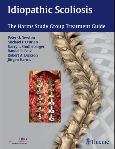 Idiopathic Scoliosis: The Harms Study Group Treatment Guide