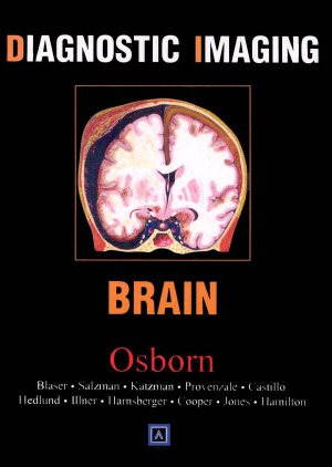 Diagnostic Imaging  Brain