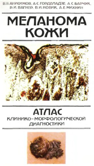 Меланома кожи. Атлас клинико-морфологической диагностики