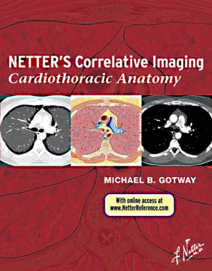 Netter's Correlative Imaging- Cardiothoracic Anatomy
