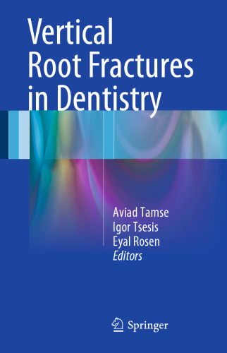 Vertical Root Fractures in Dentistry