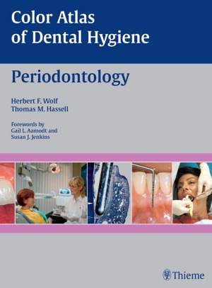 Color Atlas of Dental Hygiene  Periodontology