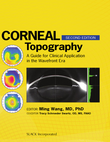 Corneal Topography: A Guide for Clinical Application in Wavefront Era