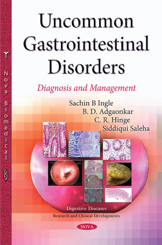 Uncommon Gastrointestinal Disorders: Diagnosis and Management