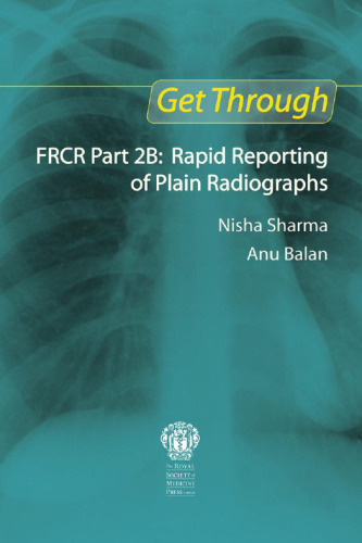 Get through FRCR part 2B : rapid reporting of plain radiographs