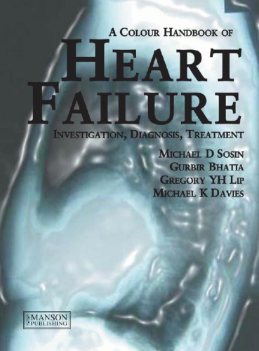 A colour handbook of heart failure : investigation, diagnosis, treatment