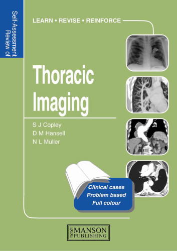 Self-assessment Colour Review of Thoracic Imaging