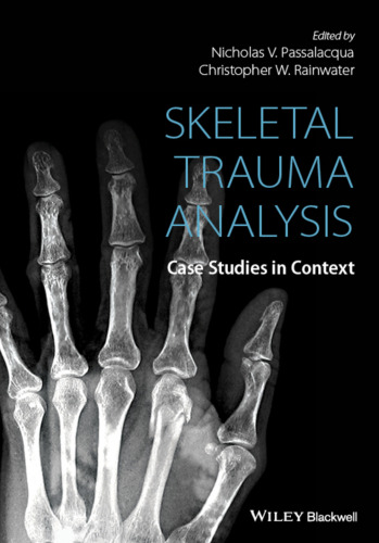 Skeletal Trauma Analysis: Case Studies in Context