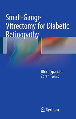 Small-Gauge Vitrectomy for Diabetic Retinopathy