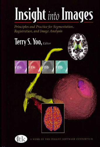 Insight into images: principles and practice for segmentation, registration, and image analysis