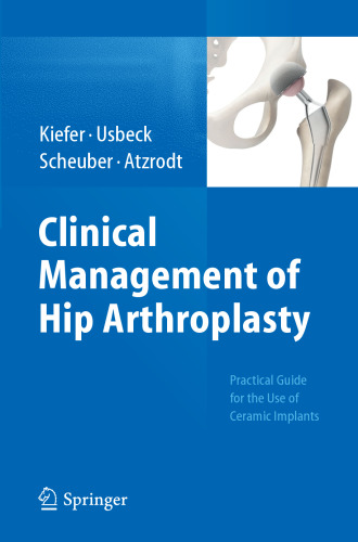Clinical Management of Hip Arthroplasty: Practical Guide for the Use of Ceramic Implants