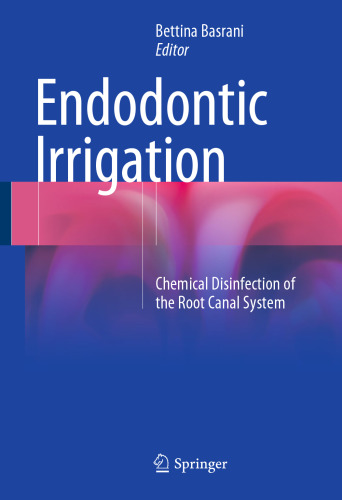 Endodontic Irrigation: Chemical disinfection of the root canal system