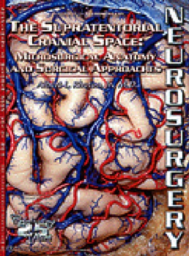 The Supratentorial cranial space : microsurgical anatomy and surgical approaches