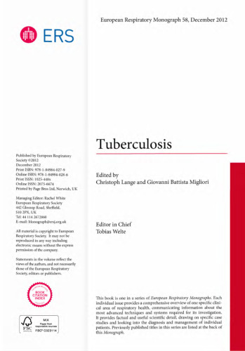 Tuberculosis