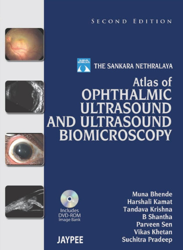 The Sankara Nethralaya Atlas of Ophthalmic Ultrasound and Ultrasound Biomicroscopy