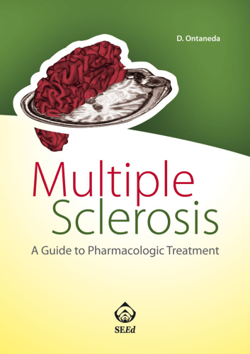 Multiple sclerosis : a guide to pharmacologic treatment