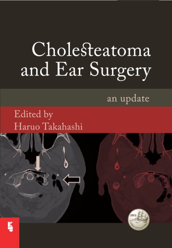 Cholesteatoma and Ear Surgery  From Theory to Practise