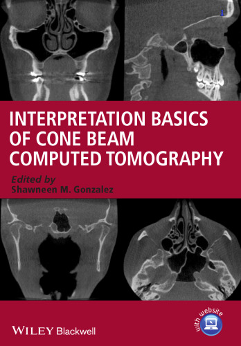 Interpretation basics of cone beam computed tomography