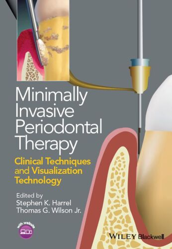 Minimally Invasive Periodontal Therapy: Clinical Techniques and Visualization Technology