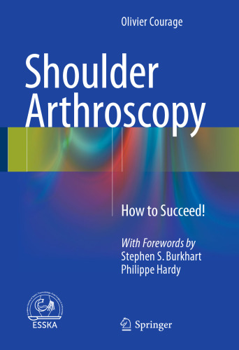 Shoulder Arthroscopy: How to Succeed!