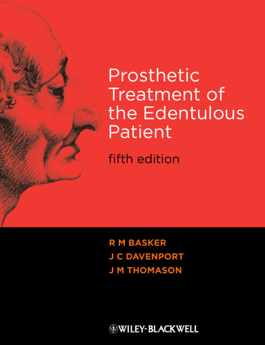 Prosthetic Treatment of the Edentulous Patient