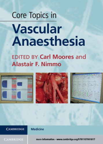 Core Topics in Vascular Anaesthesia
