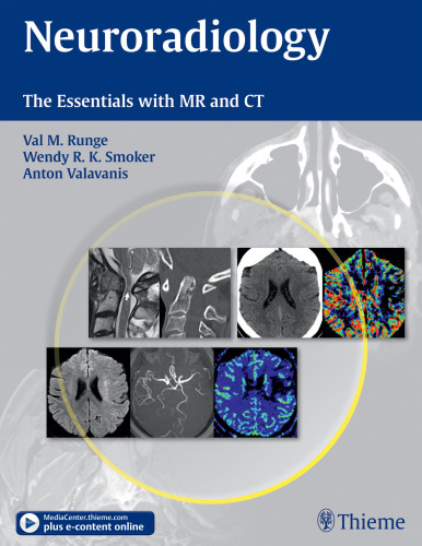 Neuroradiology: The Essentials with MR and CT