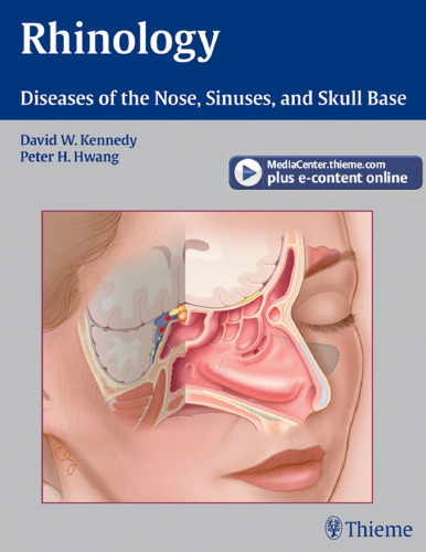 Rhinology: Diseases of the Nose, Sinuses, and Skull Base