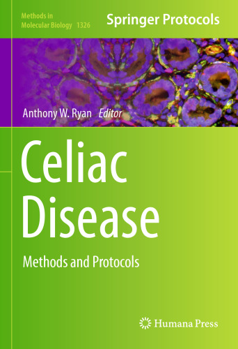 Celiac Disease: Methods and Protocols