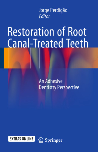 Restoration of Root Canal-Treated Teeth: An Adhesive Dentistry Perspective