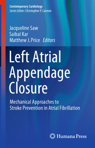Left Atrial Appendage Closure: Mechanical Approaches to Stroke Prevention in Atrial Fibrillation