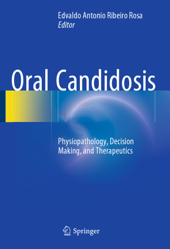Oral Candidosis: Physiopathology, Decision Making, and Therapeutics