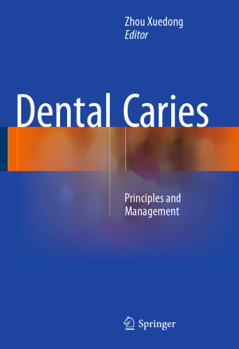 Dental Caries: Principles and Management