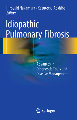 Idiopathic Pulmonary Fibrosis: Advances in Diagnostic Tools and Disease Management