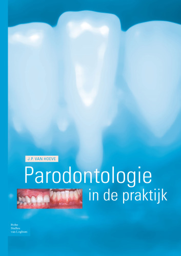 Parodontologie in de Praktijk