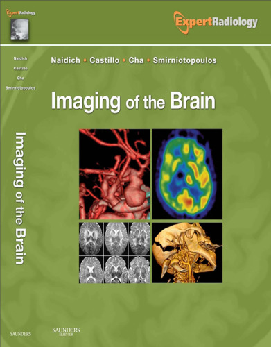 Imaging of the Brain