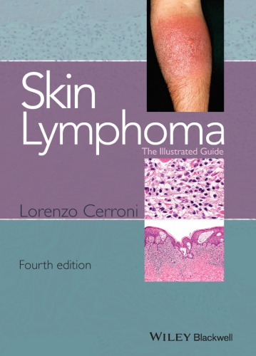 Skin Lymphoma: The Illustrated Guide