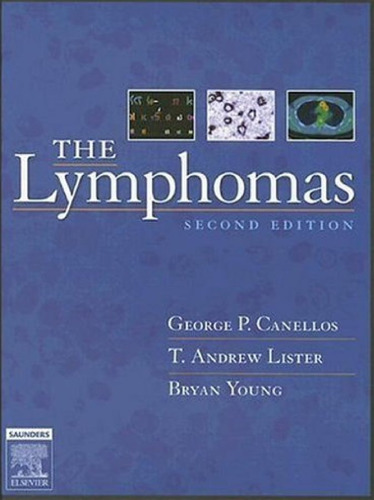 The Lymphomas