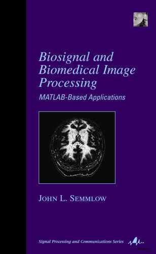 Biosignal and medical image processing. MATLAB based applications