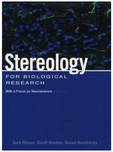 Stereology for Biological Research with a Focus on Neuroscience
