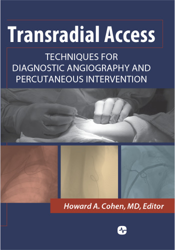 Transradial Access: Techniques for Diagnostic Angiography and Percutaneous Intervention
